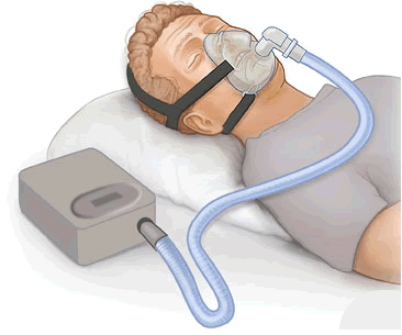 Máquina de CPAP